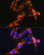 CD13 Antibody in Immunocytochemistry (ICC/IF)