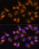 CD13 Antibody in Immunocytochemistry (ICC/IF)