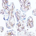 CD13 Antibody in Immunohistochemistry (Paraffin) (IHC (P))