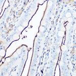 CD13 Antibody in Immunohistochemistry (Paraffin) (IHC (P))