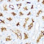 CD13 Antibody in Immunohistochemistry (Paraffin) (IHC (P))