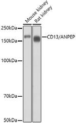 CD13 Antibody in Western Blot (WB)