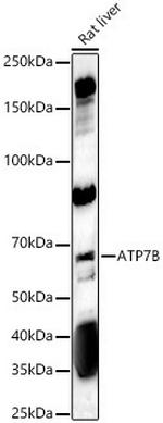 ATP7B Antibody in Western Blot (WB)