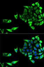 GOT1 Antibody in Immunocytochemistry (ICC/IF)