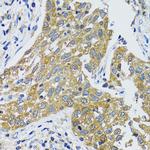 GOT1 Antibody in Immunohistochemistry (Paraffin) (IHC (P))