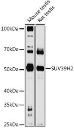 SUV39H2 Antibody in Western Blot (WB)