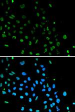 Ku80 Antibody in Immunocytochemistry (ICC/IF)