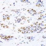 Ku80 Antibody in Immunohistochemistry (Paraffin) (IHC (P))