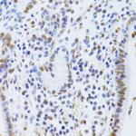 Ku80 Antibody in Immunohistochemistry (Paraffin) (IHC (P))