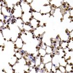 FBXW7 Antibody in Immunohistochemistry (Paraffin) (IHC (P))