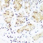 AGO2 Antibody in Immunohistochemistry (Paraffin) (IHC (P))