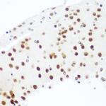 AGO2 Antibody in Immunohistochemistry (Paraffin) (IHC (P))