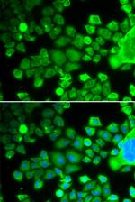 RPS10 Antibody in Immunocytochemistry (ICC/IF)