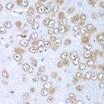 RPS10 Antibody in Immunohistochemistry (Paraffin) (IHC (P))