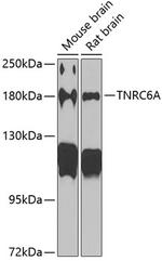 TNRC6A Antibody in Western Blot (WB)