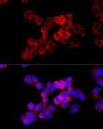 CTH Antibody in Immunocytochemistry (ICC/IF)