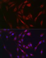 FGF23 Antibody in Immunocytochemistry (ICC/IF)