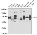 IRF6 Antibody in Western Blot (WB)