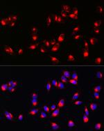 Melan-A Antibody in Immunocytochemistry (ICC/IF)