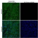 Melan-A Antibody in Immunohistochemistry (Paraffin) (IHC (P))