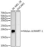 Melan-A Antibody in Western Blot (WB)