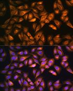 SOAT1 Antibody in Immunocytochemistry (ICC/IF)