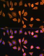 SOAT1 Antibody in Immunocytochemistry (ICC/IF)