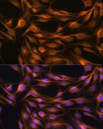 SOAT1 Antibody in Immunocytochemistry (ICC/IF)