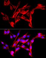 FAP Antibody in Immunocytochemistry (ICC/IF)