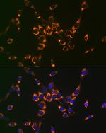 ASL Antibody in Immunocytochemistry (ICC/IF)