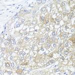 ASL Antibody in Immunohistochemistry (Paraffin) (IHC (P))