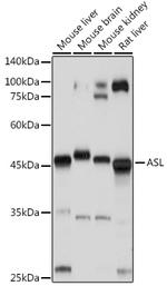 ASL Antibody in Western Blot (WB)