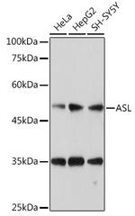 ASL Antibody in Western Blot (WB)