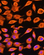 DTYMK Antibody in Immunocytochemistry (ICC/IF)