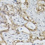 ELF3 Antibody in Immunohistochemistry (Paraffin) (IHC (P))