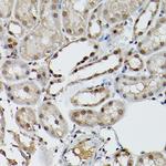 ELF3 Antibody in Immunohistochemistry (Paraffin) (IHC (P))