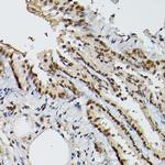 ELF3 Antibody in Immunohistochemistry (Paraffin) (IHC (P))