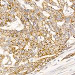 Glycerol kinase Antibody in Immunohistochemistry (Paraffin) (IHC (P))