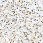 BAP1 Antibody in Immunohistochemistry (Paraffin) (IHC (P))