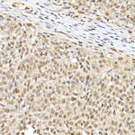 BAP1 Antibody in Immunohistochemistry (Paraffin) (IHC (P))