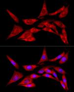 LZIP Antibody in Immunocytochemistry (ICC/IF)