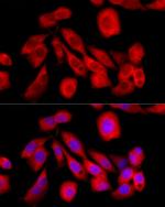 LZIP Antibody in Immunocytochemistry (ICC/IF)