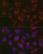 GPLD1 Antibody in Immunocytochemistry (ICC/IF)