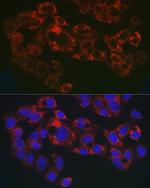 GPLD1 Antibody in Immunocytochemistry (ICC/IF)