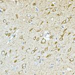 GPLD1 Antibody in Immunohistochemistry (Paraffin) (IHC (P))