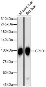 GPLD1 Antibody in Western Blot (WB)