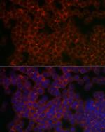 PIK3CG Antibody in Immunocytochemistry (ICC/IF)