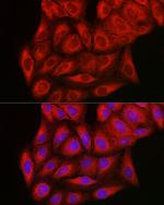 PIK3CG Antibody in Immunocytochemistry (ICC/IF)