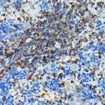 PIK3CG Antibody in Immunohistochemistry (Paraffin) (IHC (P))