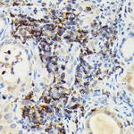 PIK3CG Antibody in Immunohistochemistry (Paraffin) (IHC (P))